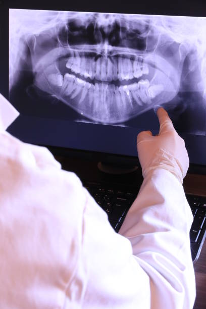 Best Emergency Root Canal Treatment in Newport, DE