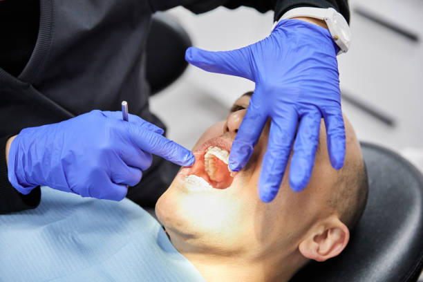 Best Emergency Treatment for Dental Infections or Abscesses in Newport, DE